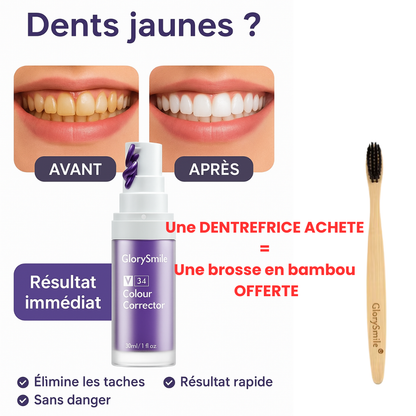 Sourire Éclatant : Le Correcteur de Couleur Dentaire Violet