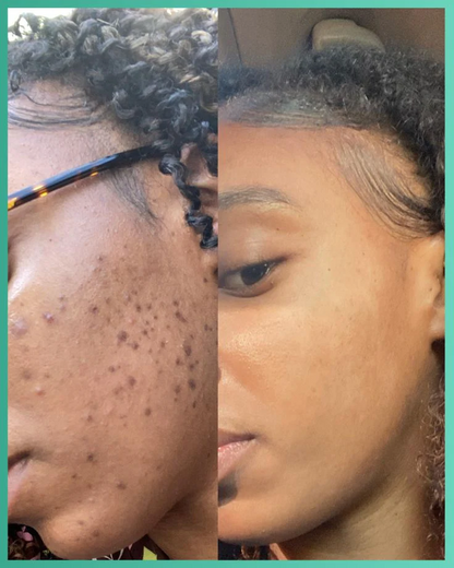 Masque Stick Purifiant au Thé Vert - Dites Adieu aux Imperfections